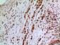 SAMHD1 Polyclonal Antibody